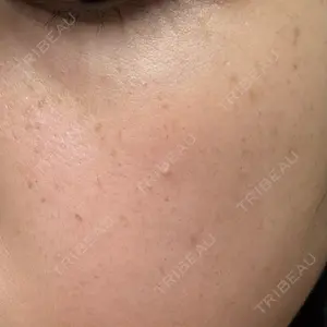 ルラ美容クリニック 静岡院口コミ