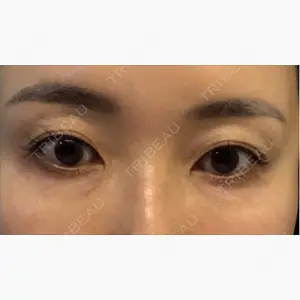 APスキンクリニック銀座口コミ