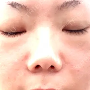 博多美容外科/美容皮膚科 ビラビューティークリニック口コミ