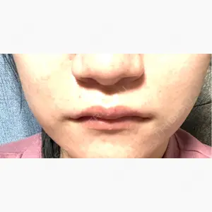 千葉美容外科アイビークリニック口コミ