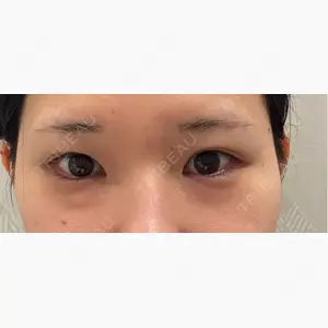 銀座みゆき通り美容外科 大阪梅田院口コミ