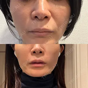 ライズワン美容皮膚科クリニック口コミ