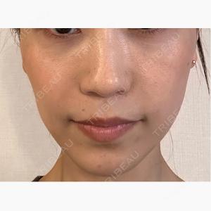 La Clinique Nagoya Sakae【ラクリニック名古屋】口コミ