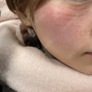 REVI CLINIC銀座院 口コミ