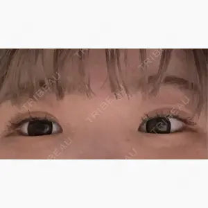 フィラークリニック 大阪梅田院口コミ