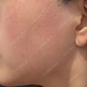 Tokyo Tensei Clinic 新宿院口コミ