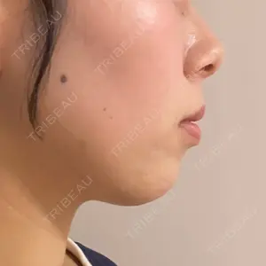 ルラ美容クリニック 福岡本院口コミ