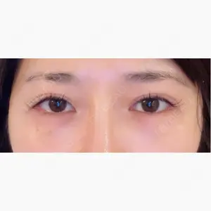 ネビュラクリニック 東京錦糸町院口コミ