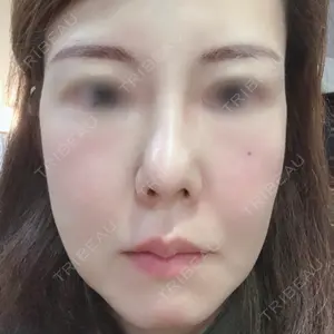 清潭女神美容外科口コミ