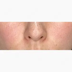 NARU Beauty Clinic 【ナルクリ】 水戸院口コミ