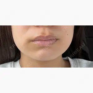 品川スキンクリニック 宇都宮院（※品川美容外科提携）口コミ