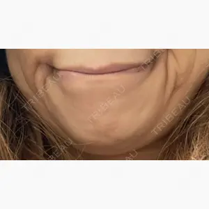 札幌美容外科ネビュラクリニック口コミ