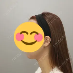 銀座みゆき通り美容外科 大阪梅田院口コミ