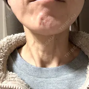 ルラ美容クリニック 町田院口コミ