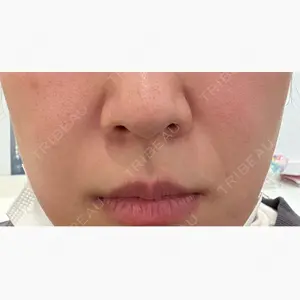 ルラ美容クリニック 福岡天神院口コミ