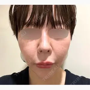 東京美容外科 赤坂院口コミ