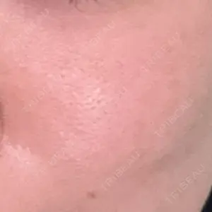 ミニマムスキンクリニック池袋口コミ