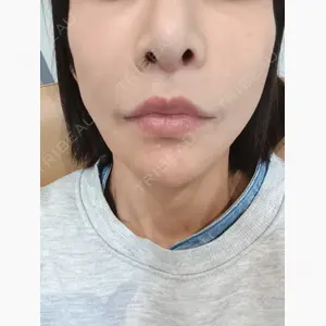 id（アイディ）美容外科口コミ