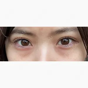 LA CLEF CLINIC（ラクレクリニック）口コミ