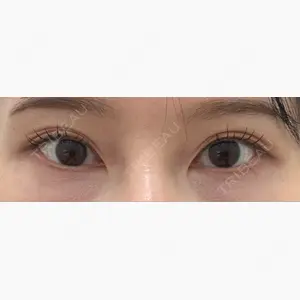 TCB東京中央美容外科 名古屋栄院口コミ