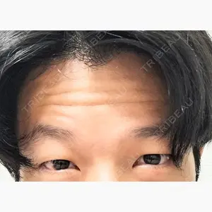 千葉美容外科アイビークリニック口コミ