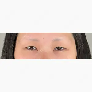 アリエル美容クリニック 水戸院口コミ