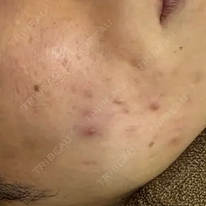 ゆきスキンクリニック 東池袋口コミ