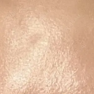 美容皮膚科エルムクリニック 麻布院口コミ