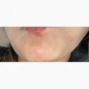 札幌TAクリニック口コミ