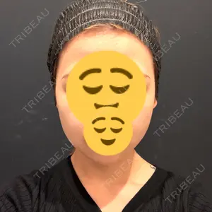 渋谷あおぞらクリニック美容外科・美容皮膚科口コミ