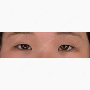 アリエル美容クリニック 水戸院口コミ