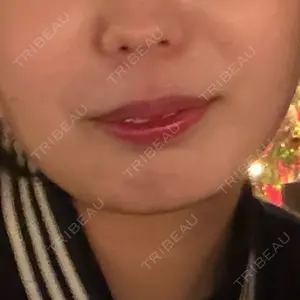 plume clinic口コミ