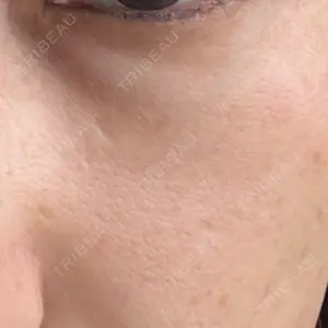 DMTC美容皮膚科 大宮院口コミ