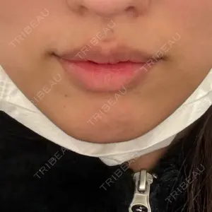 アリエル美容クリニック 水戸院口コミ