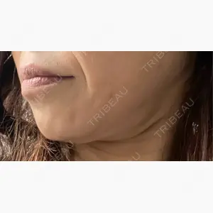 TCB東京中央美容外科 札幌駅前院口コミ