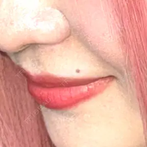 R Beauty CLINIC 名古屋院口コミ