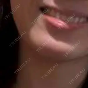 こさか内科・内視鏡内科　医療脱毛口コミ