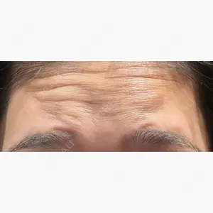 銀座TAクリニック口コミ