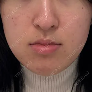 ルラ美容クリニック 郡山院口コミ