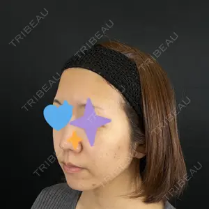 藤・ナチュレ美容クリニック 銀座院口コミ