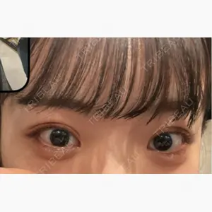 HAAB×DREAM BEAUTY CLINIC 大阪梅田院口コミ