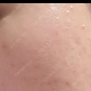 さっぽろ美容クリニック口コミ