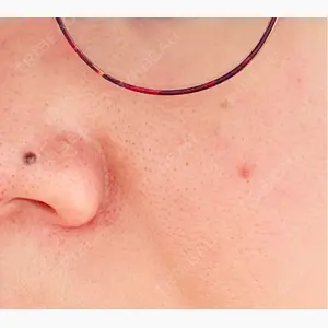 Fellez Clinic【フェルズクリニック】口コミ