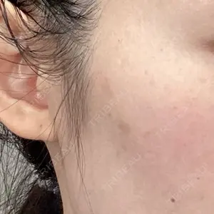 エトワールレジーナクリニック新宿院口コミ