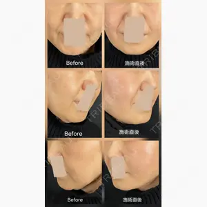 藤・ナチュレ美容クリニック 銀座院口コミ