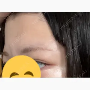 HAAB×DREAM BEAUTY CLINIC 東京本院口コミ