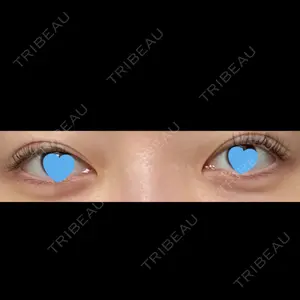 札幌美容外科ネビュラクリニック口コミ