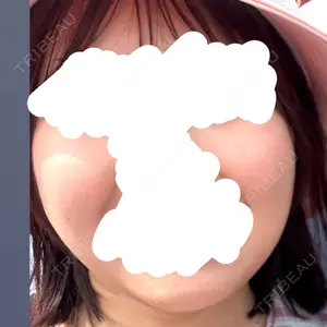 TCB東京中央美容外科 名古屋栄院口コミ