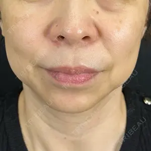 藤・ナチュレ美容クリニック 銀座院口コミ