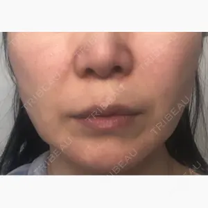 東京ココセランクリニック口コミ